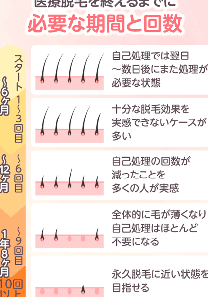 医療脱毛のベストな間隔は？適切な頻度を解説！