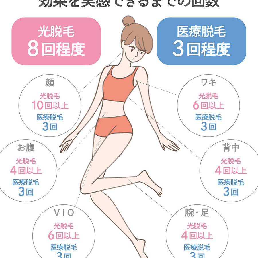 脱毛頻度は？何回で完了？期間・間隔を徹底解説！